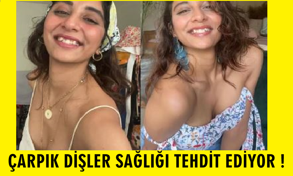 Çarpık Dişler Sorunu.. Diş Hekimi Murat İnce